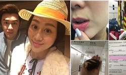 吃面包烫伤被送急救 陈浩民否认滥用救护车资源